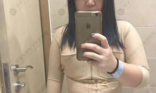 自体脂肪隆胸专家